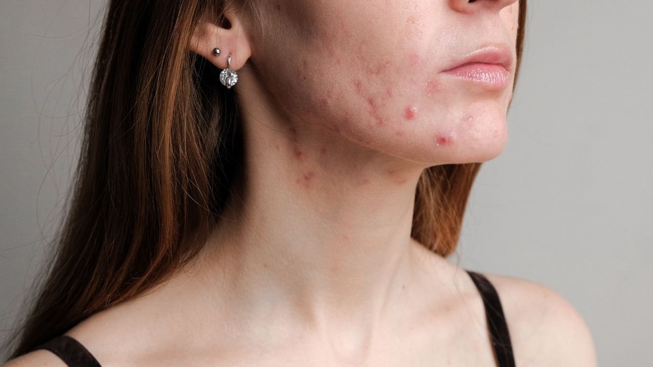 Is Coffee Bad for Your Skin?